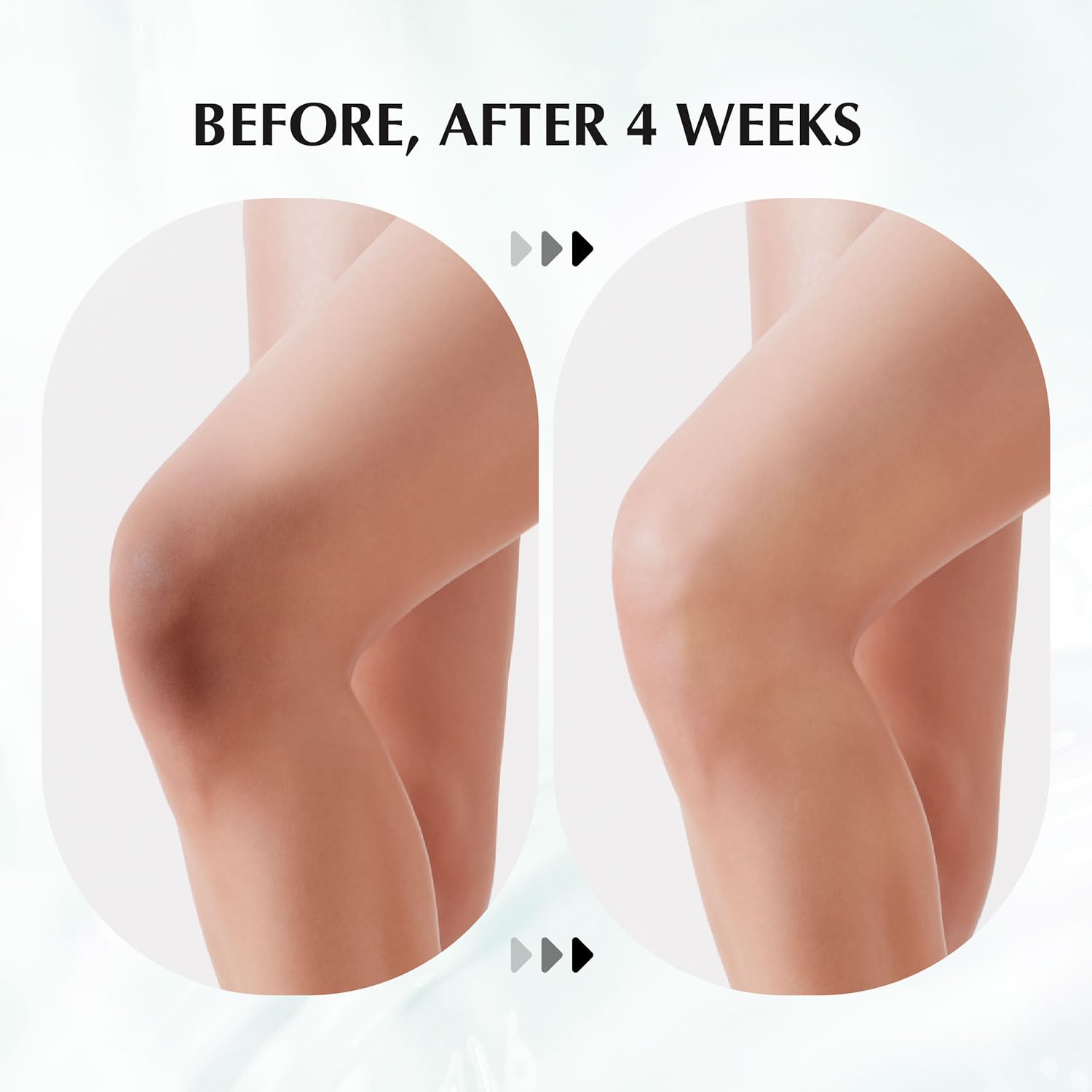 Dark Spot Corrector Body Cream