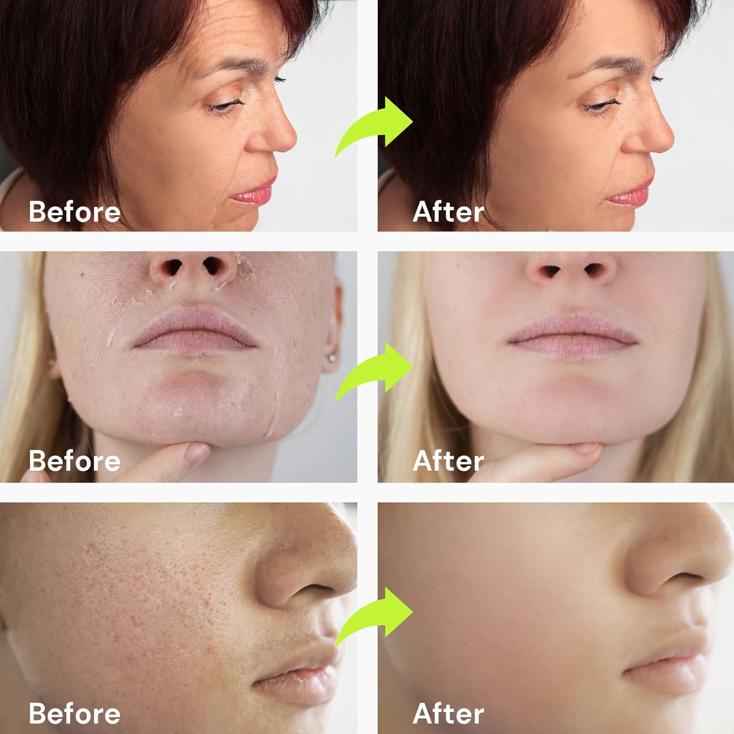 Retinol Facial Serum