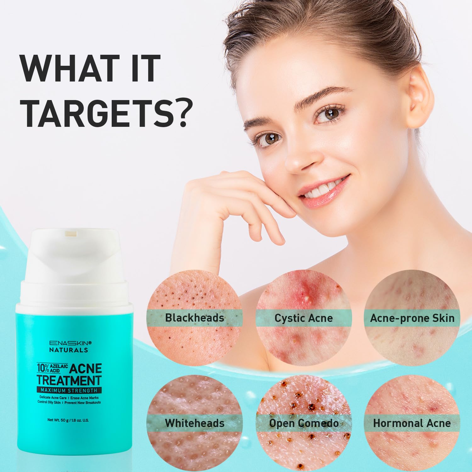 10% Azelaic Acid Acne Treatment