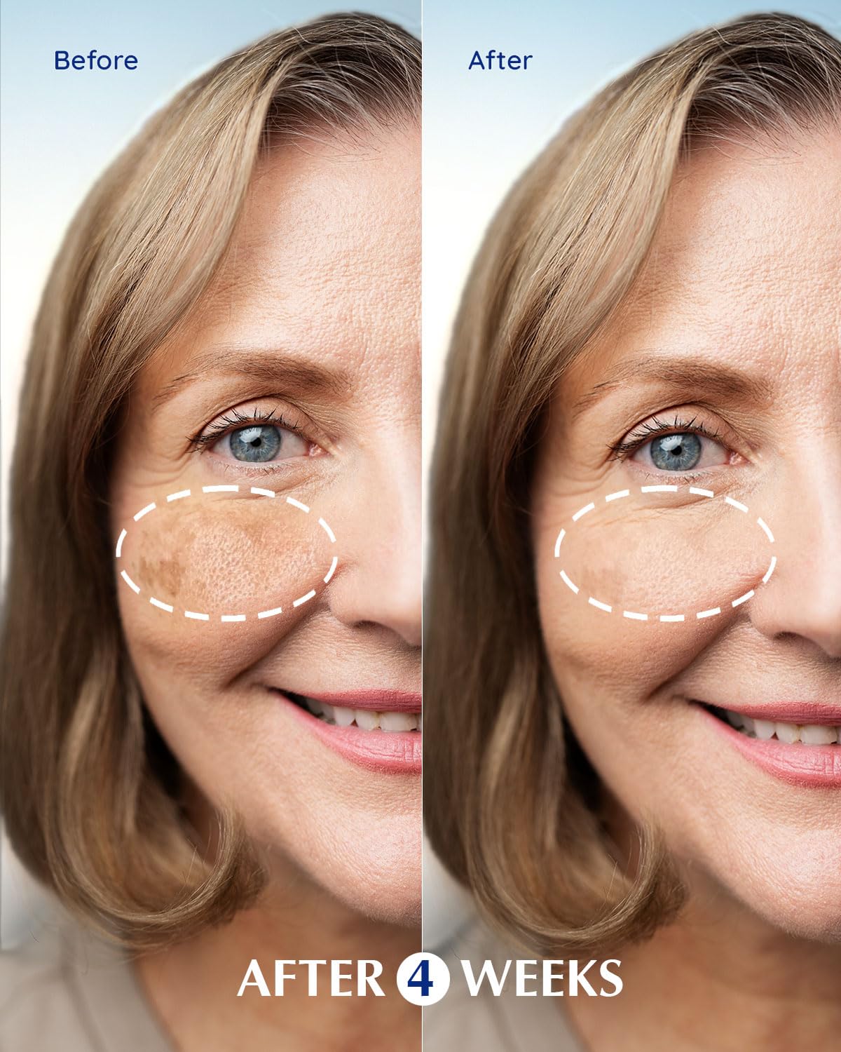 Spot Remover Wand