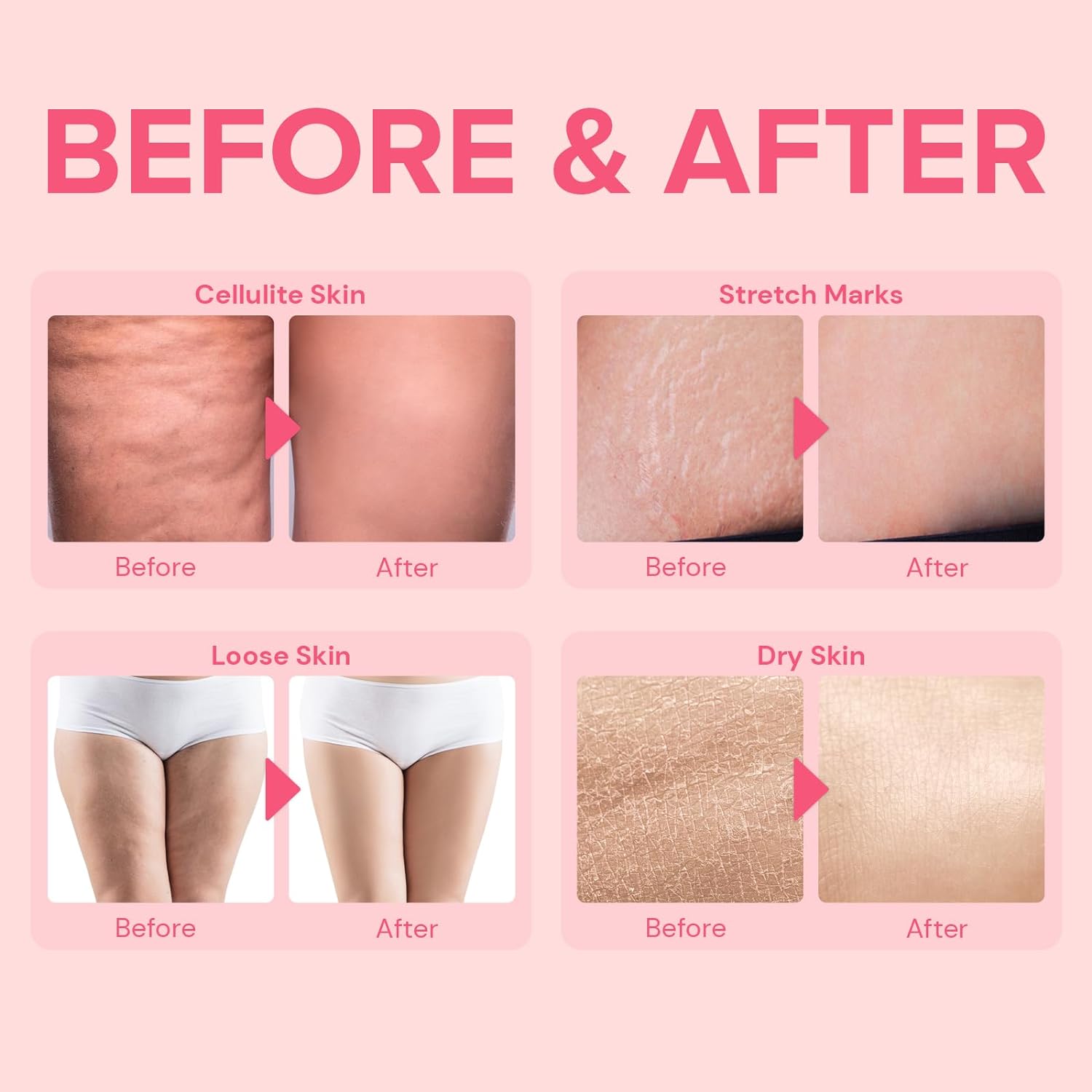Inner Thigh Firming Cream