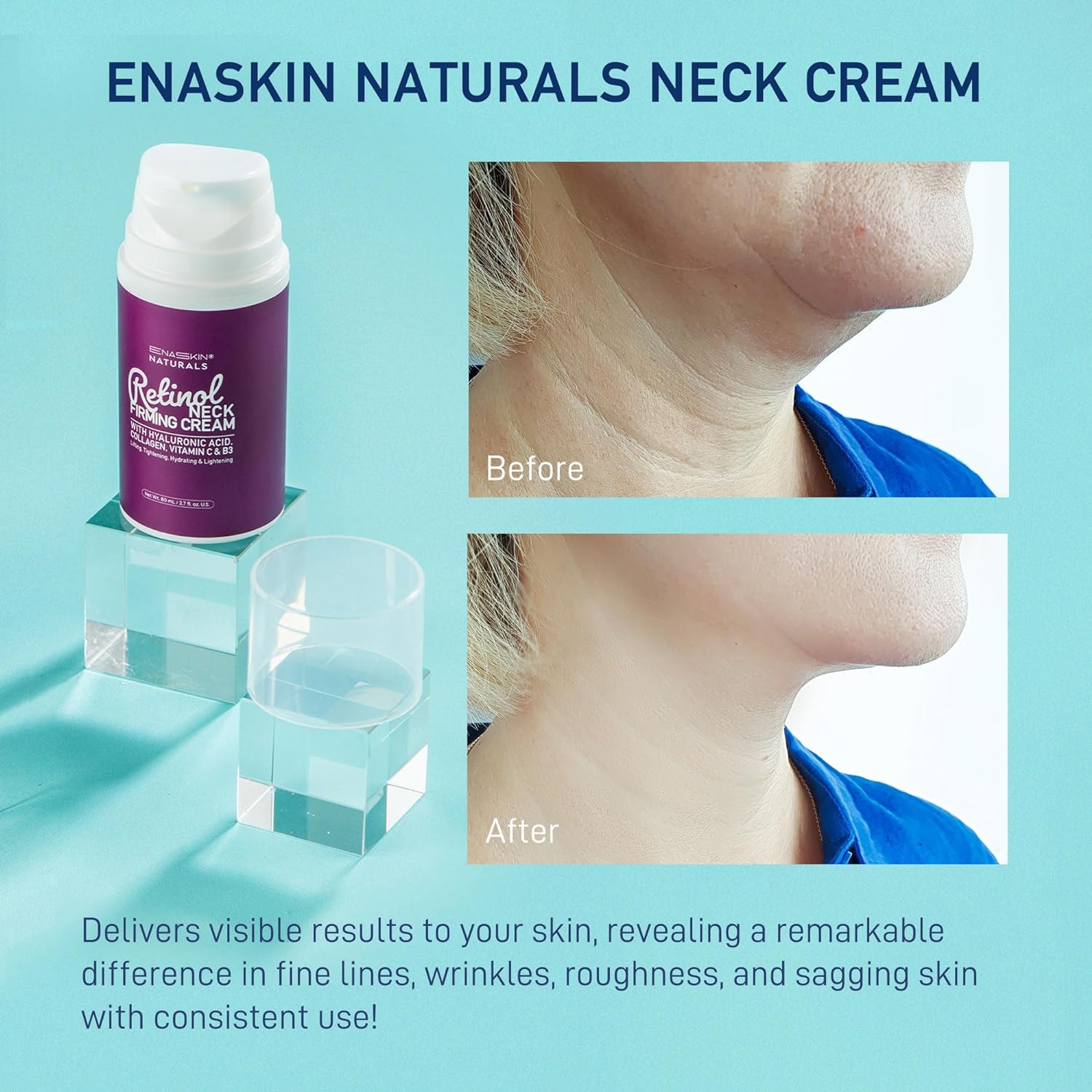 Retinol Neck Firming Cream