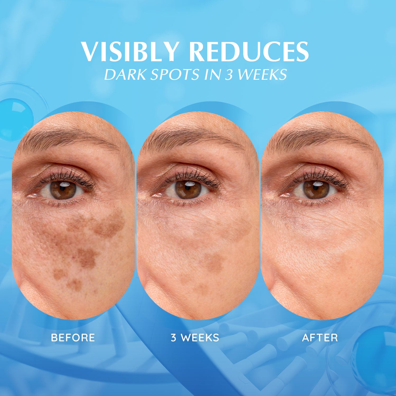 Dark Spot Corrector Face Serum