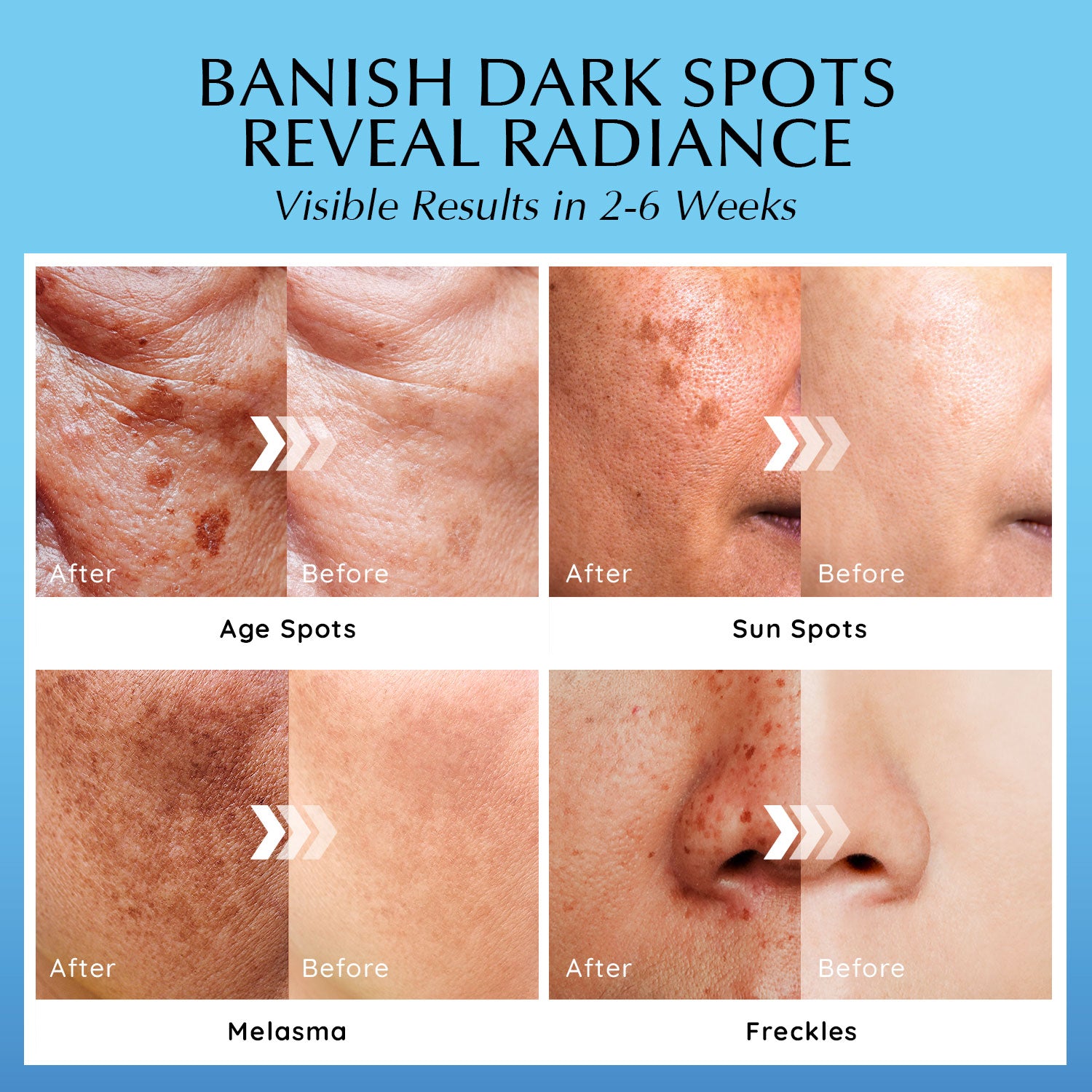 Dark Spot Corrector Face Cream
