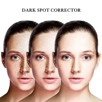 Dark Spot Remover for Face and Body 1.7 FL OZ | EnaSkin
