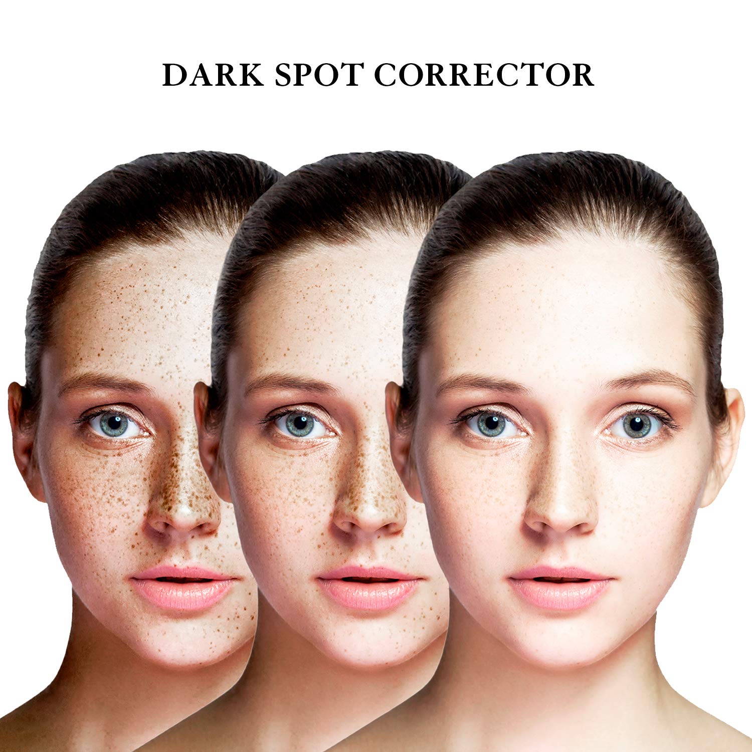 Dark Spot Corrector Remover for Face and Body 1 FL OZ | EnaSkin