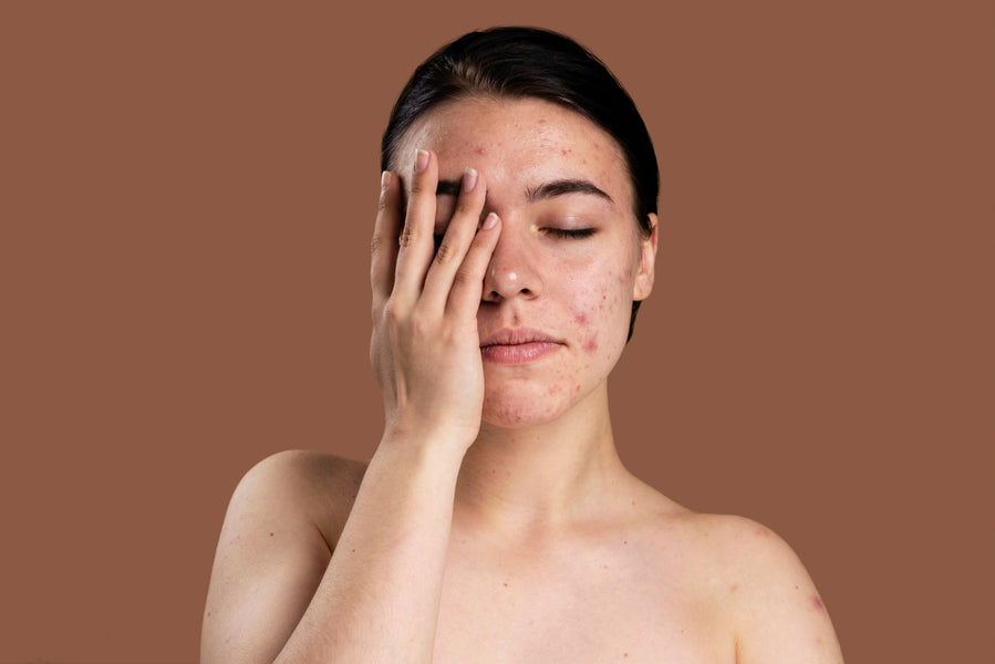 The Top 5 Ways to Prevent Dark Spots from Appearing