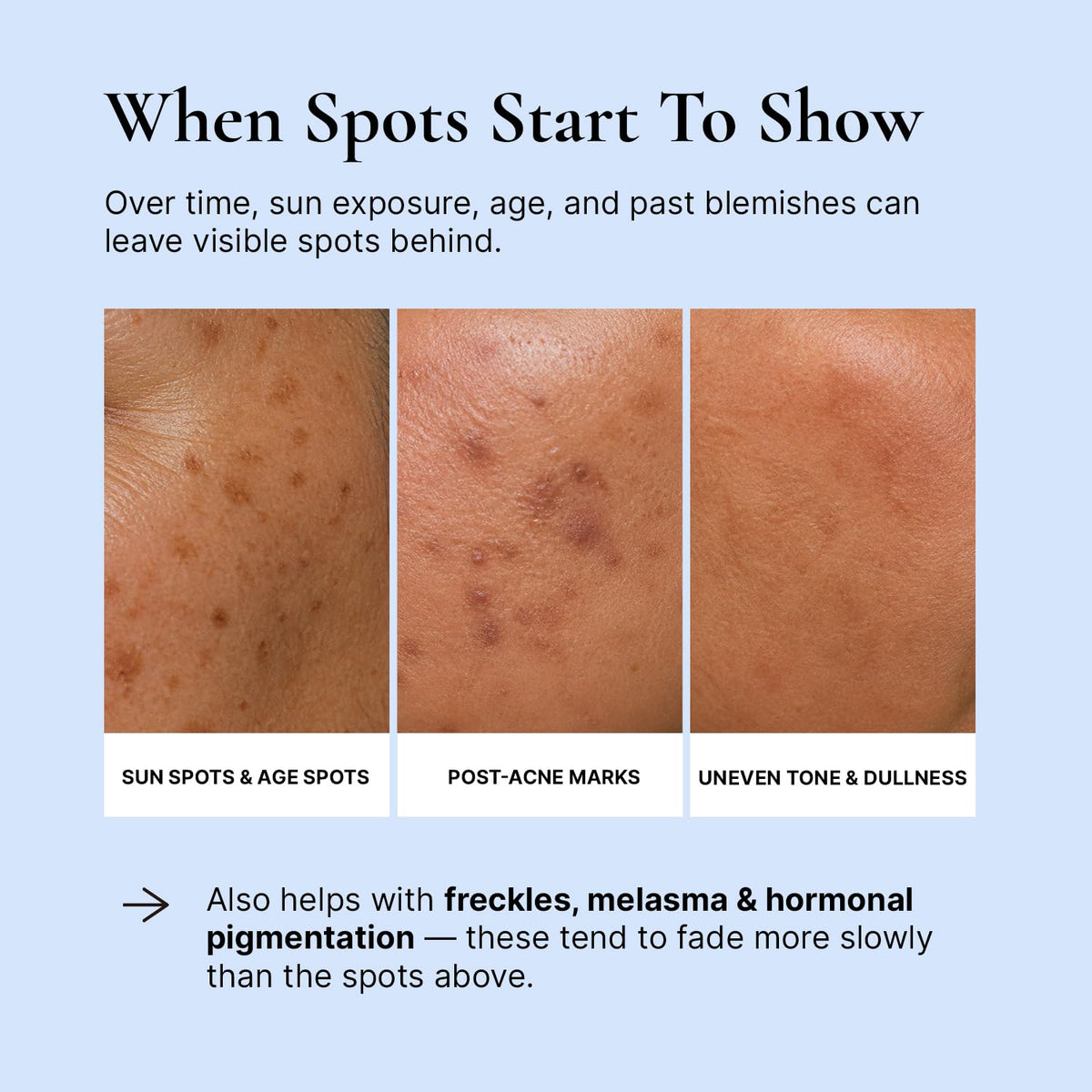 Dark Spot Corrector Cream
