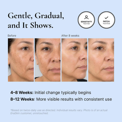 Dark Spot Corrector Cream