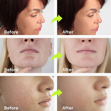 Load image into Gallery viewer, Anti Aging Retinol Facial Serum: Enaskin Naturals Korean Serum for Face - Wrinkles Reducer Treatment with Retinol &amp; Collagen &amp; Hyaluronic Acid &amp; Nicotinamide, Brightening &amp; Firming Skincare Lotion
