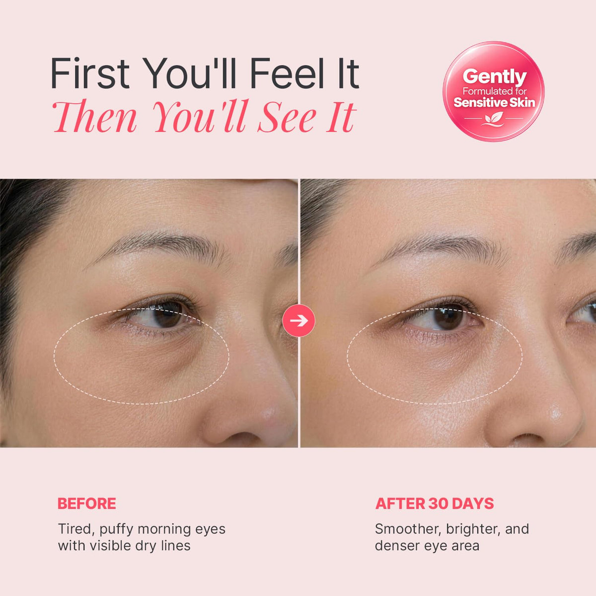 PDRN &amp; NAD+ Eye Cream