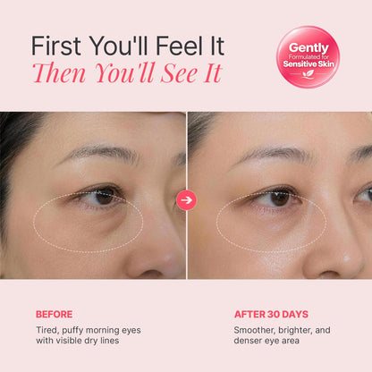 PDRN &amp; NAD+ Eye Cream