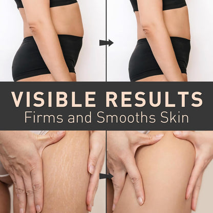 Belly Firming Cream