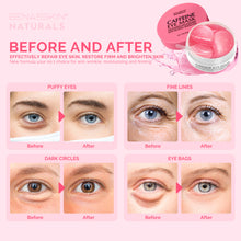 Load image into Gallery viewer, EnaSkin Dark Spot Remover for Face Wand
