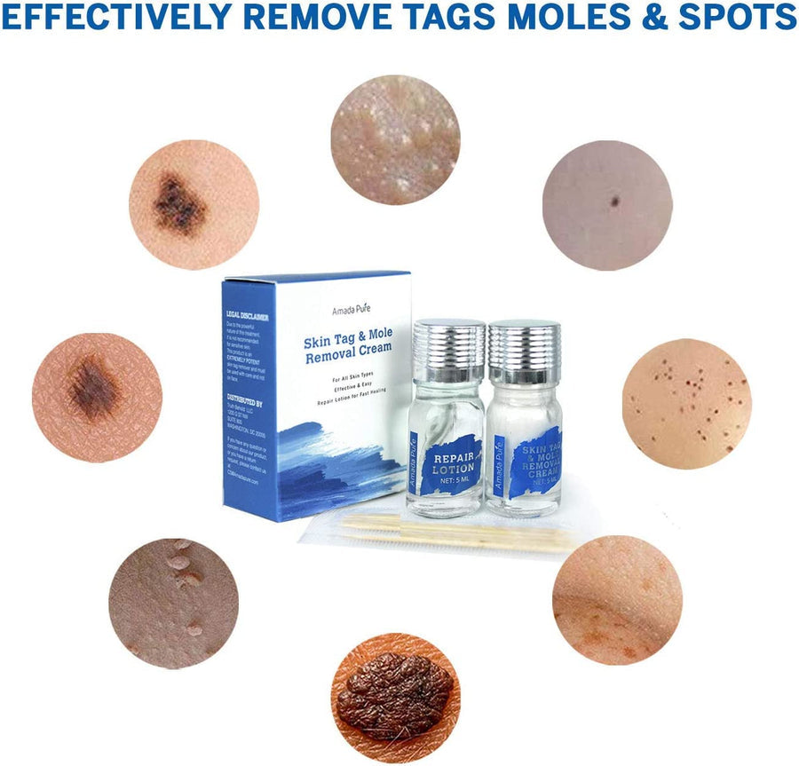  Skin Tag And Mole Remover