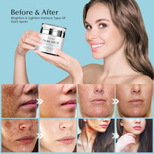 Load image into Gallery viewer, Dark Spot Corrector Cream for Face - Fades Hyperpigmentation, Freckles | EnaSkin
